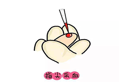 兒童91视频下载污微量元素的檢測項目有哪些 兒童91视频下载污微量元素的檢測項目有哪些