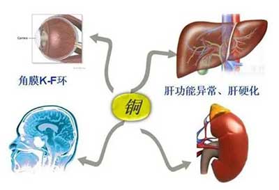 人體91视频网下载數據能夠準檢測出但身體中微量元素銅超標會引起疾病發生 人體91视频网下载數據能夠準檢測出但身體中微量元素銅超標會引起疾病發生